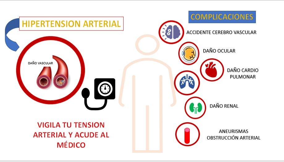 hipertension arterial ilustracion